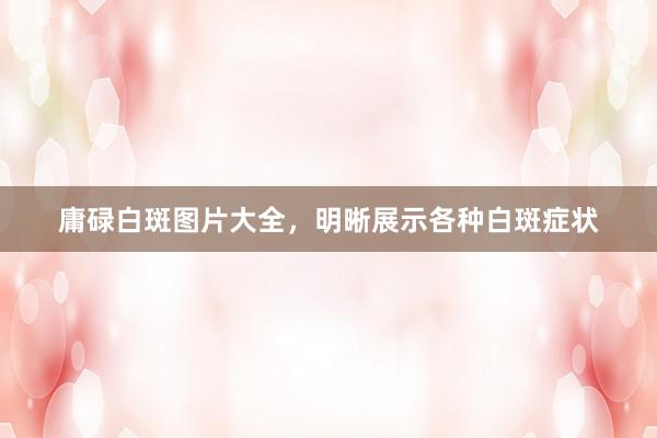 庸碌白斑图片大全，明晰展示各种白斑症状